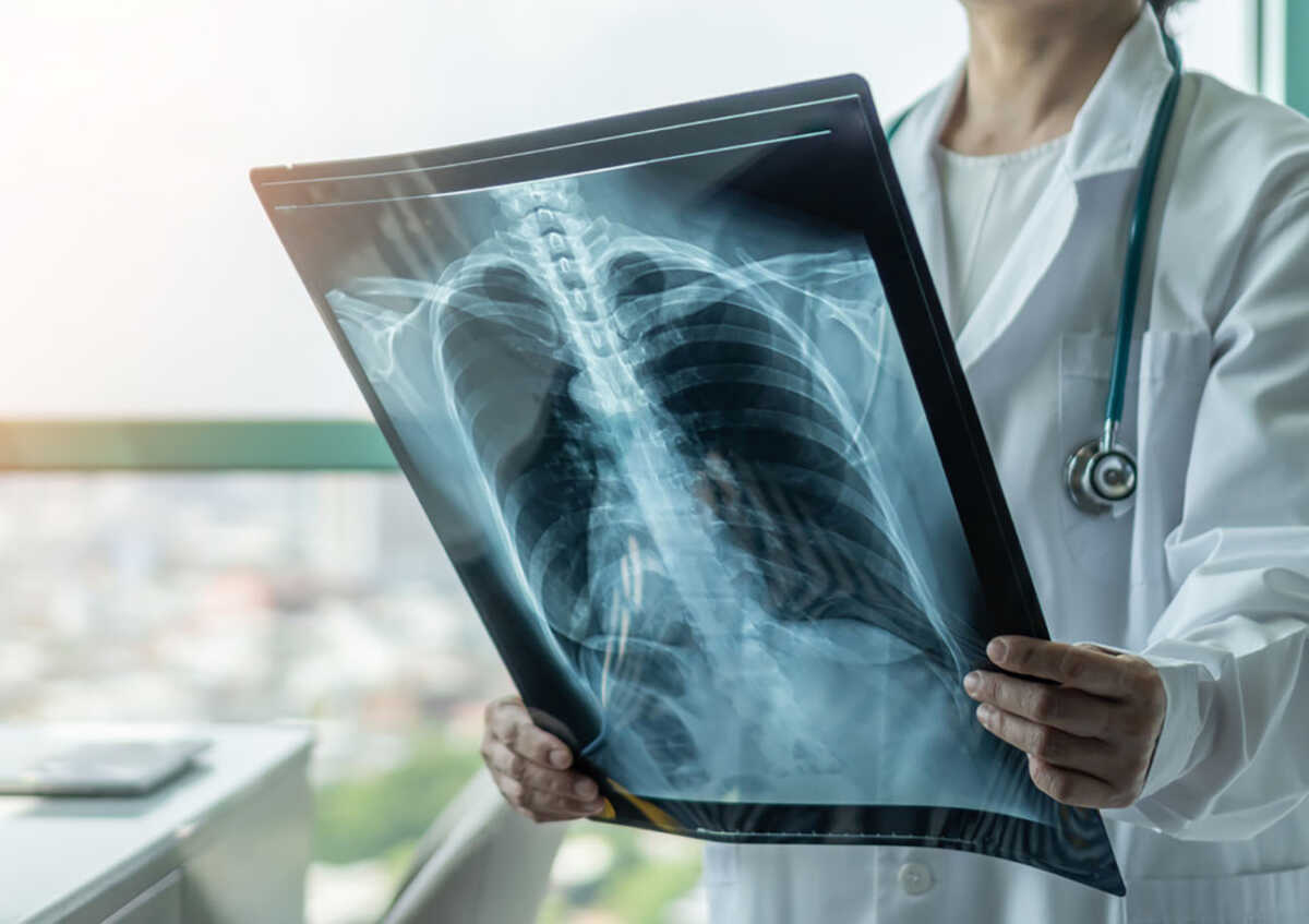 Doctor diagnosing patientâs health on asthma, lung disease, COVID-19 or bone cancer illness with radiological chest x-ray film for medical healthcare hospital service