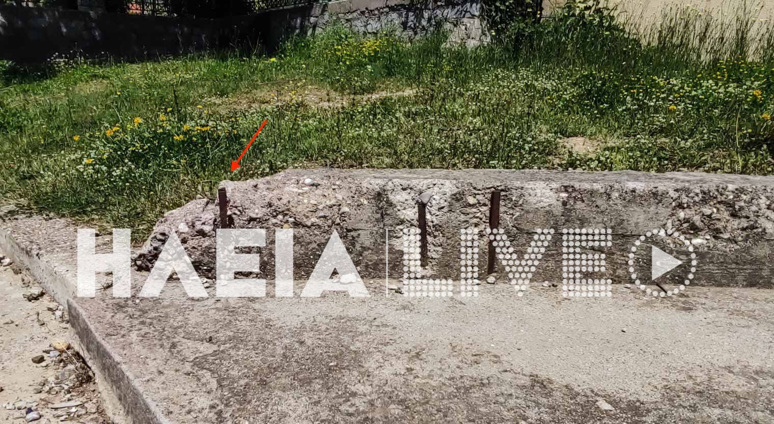 Αρχαία Ολυμπία: Κάταγμα κρανίου υπέστη 5χρονο κοριτσάκι μετά από ατύχημα σε παιδική χαρά