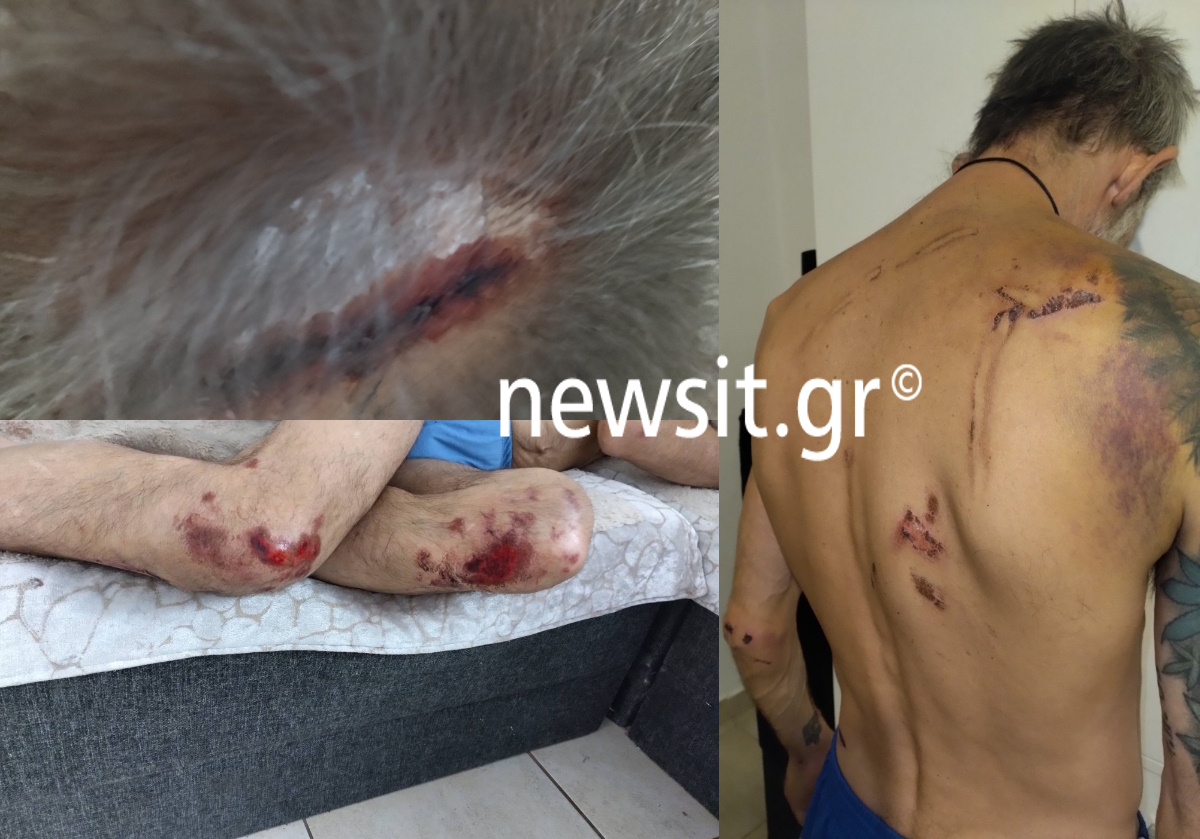Μιχάλης Κατσουρής: Εικόνες σοκ από τον ξυλοδαρμό του 48χρονου φίλου της ΑΕΚ – «Θα αξιώσουμε αποζημίωση από το Ελληνικό κράτος»