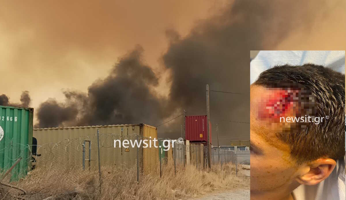 Φωτιά στον Ασπρόπυργο: Φωτογραφία ντοκουμέντο με τον τραυματία αστυνομικό στον οποίο επιτέθηκαν με τσιμεντόλιθο