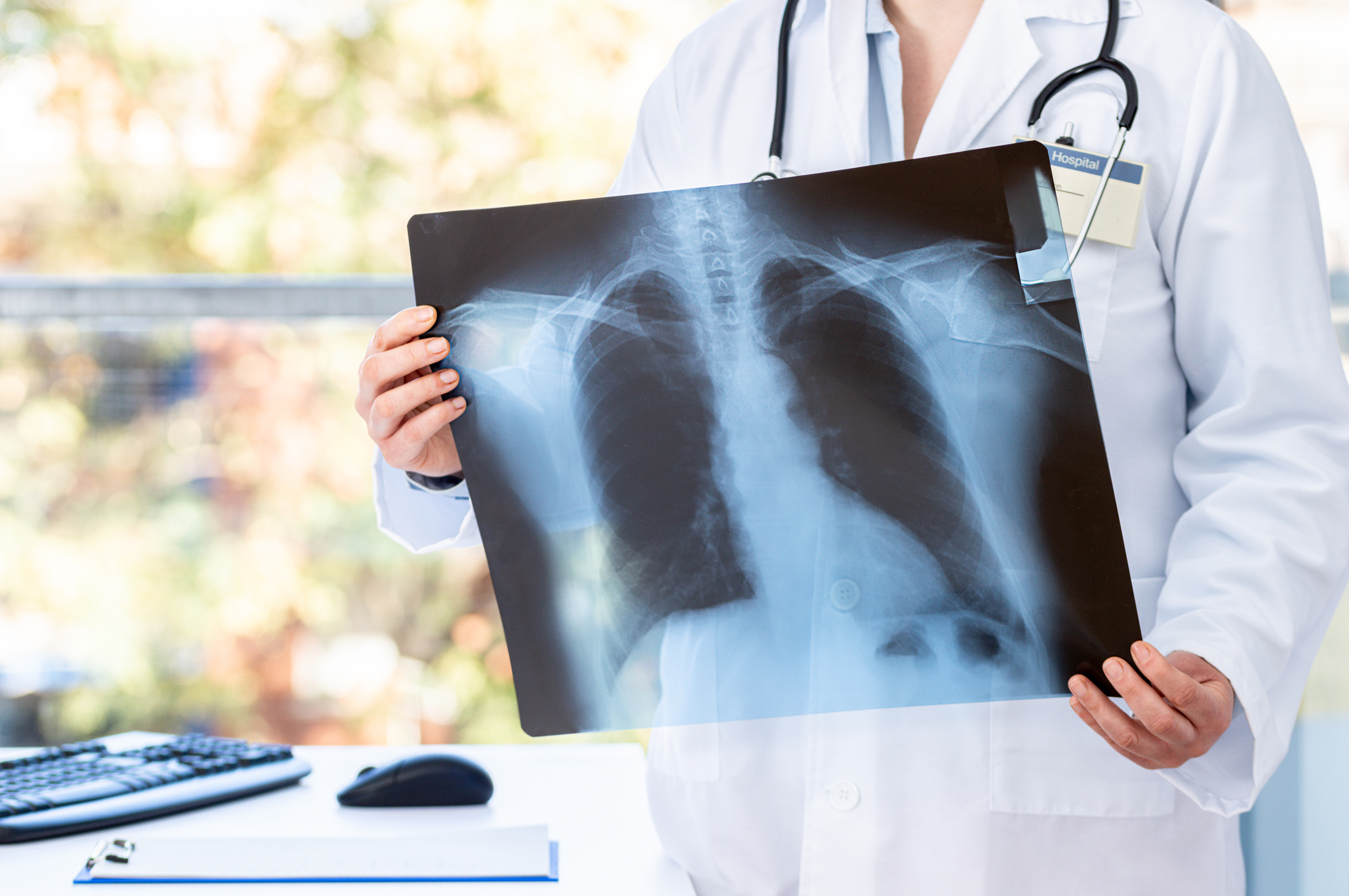 Doctor diagnosing patient's health on asthma, lung disease, long COVID-19, coronavirus or bone cancer illness with radiological chest x-ray film for medical healthcare hospital service