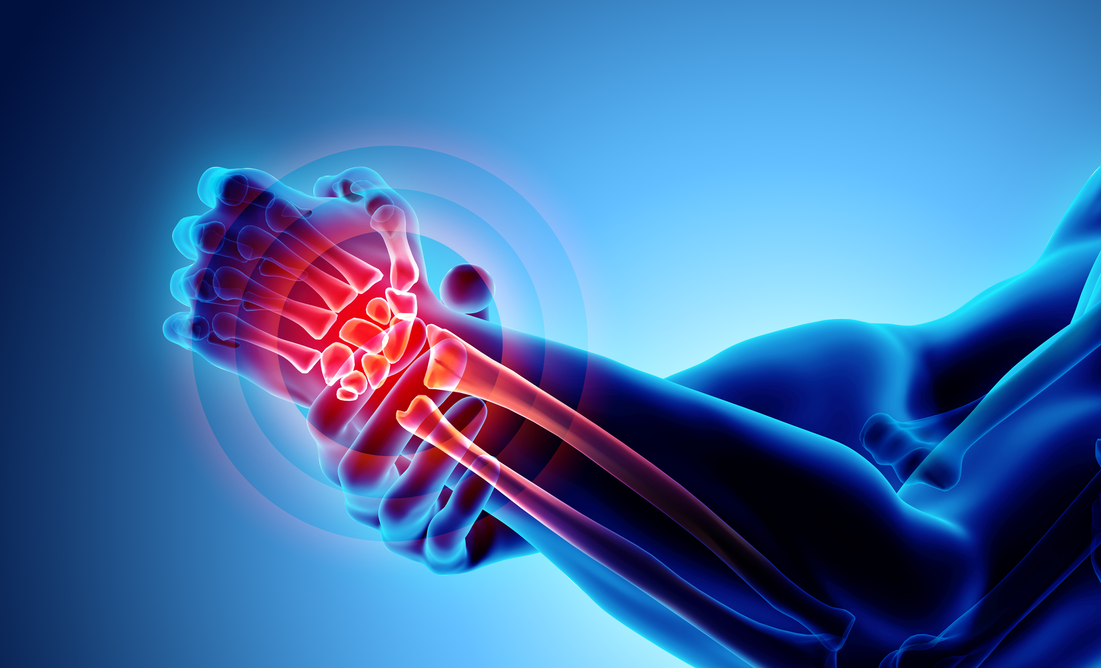 Wrist painful - skeleton x-ray, 3D Illustration medical concept.