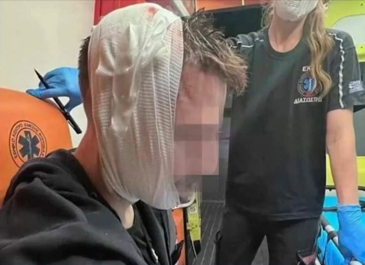 ΑΕΚ – Ντινάμο Ζάγκρεμπ: Σοκαριστική φωτογραφία τραυματία μετά τη φονική επίθεση