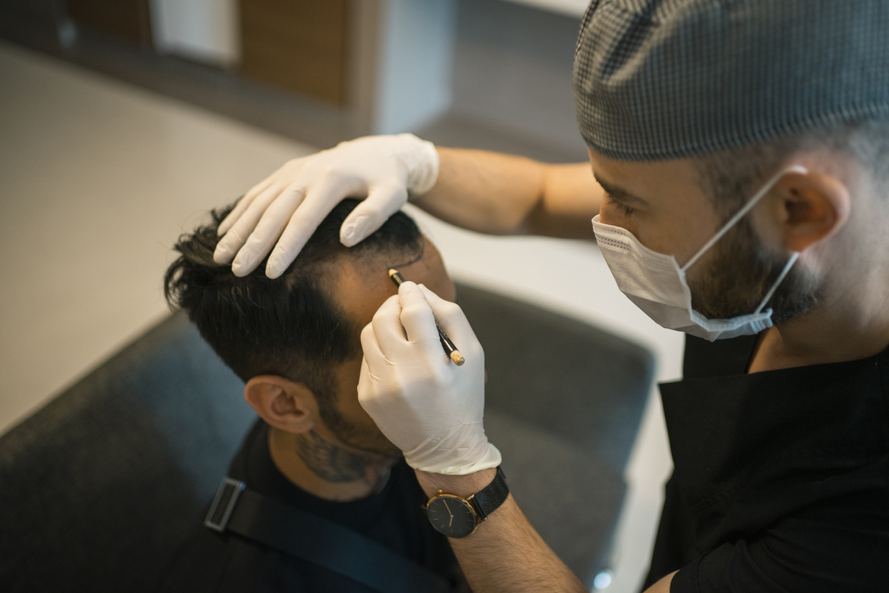 Hair transplant