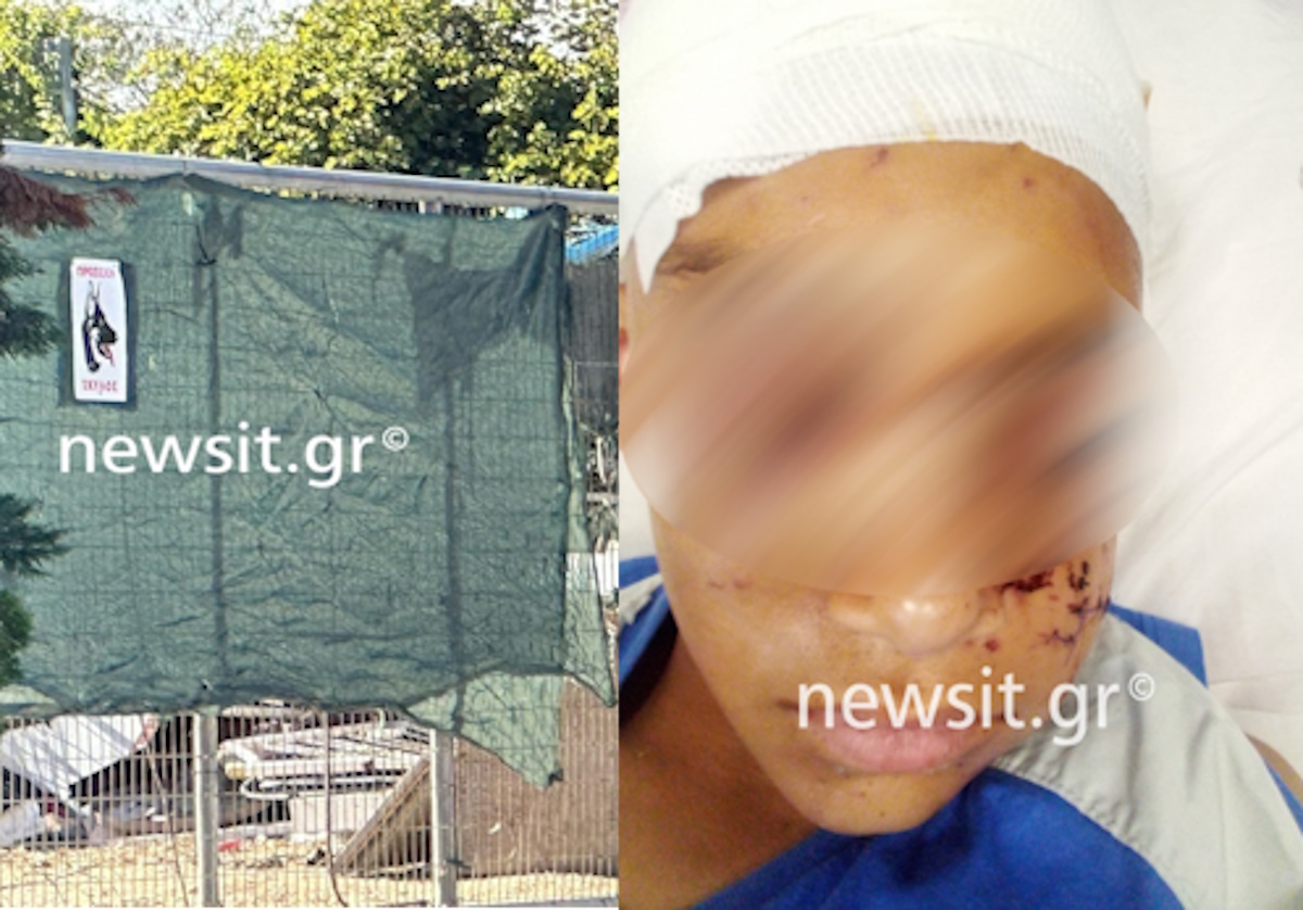 Επίθεση πιτ μπουλ σε 11χρονο στην Αρτέμιδα: «Περιμένουμε την αξονική για να δούμε πώς πάει» λέει στο newsit.gr ο πατριός του αγοριού