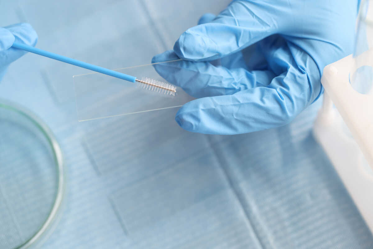 Taking vaginal smear from women on glass. Genital infections in women concept