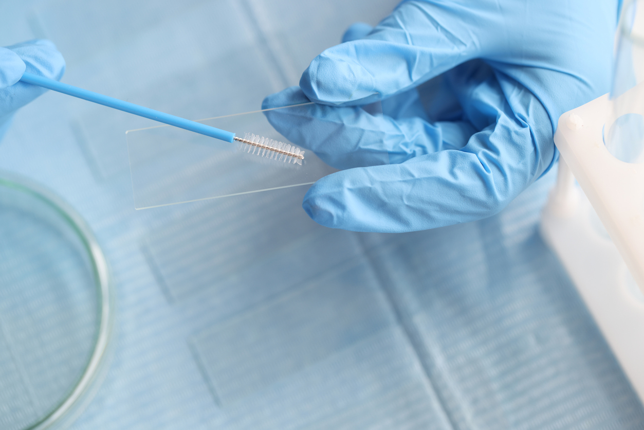 Taking vaginal smear from women on glass. Genital infections in women concept