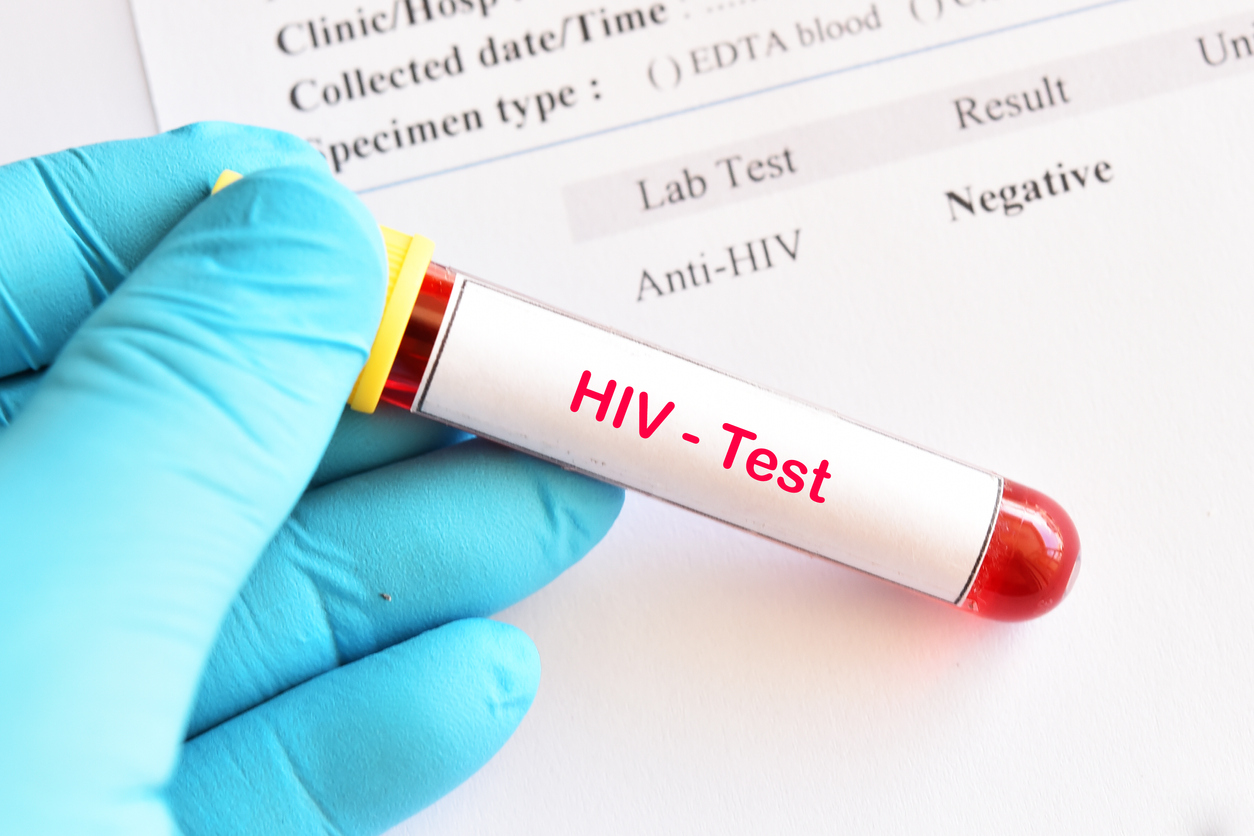 HIV negative test result with blood sample tube
