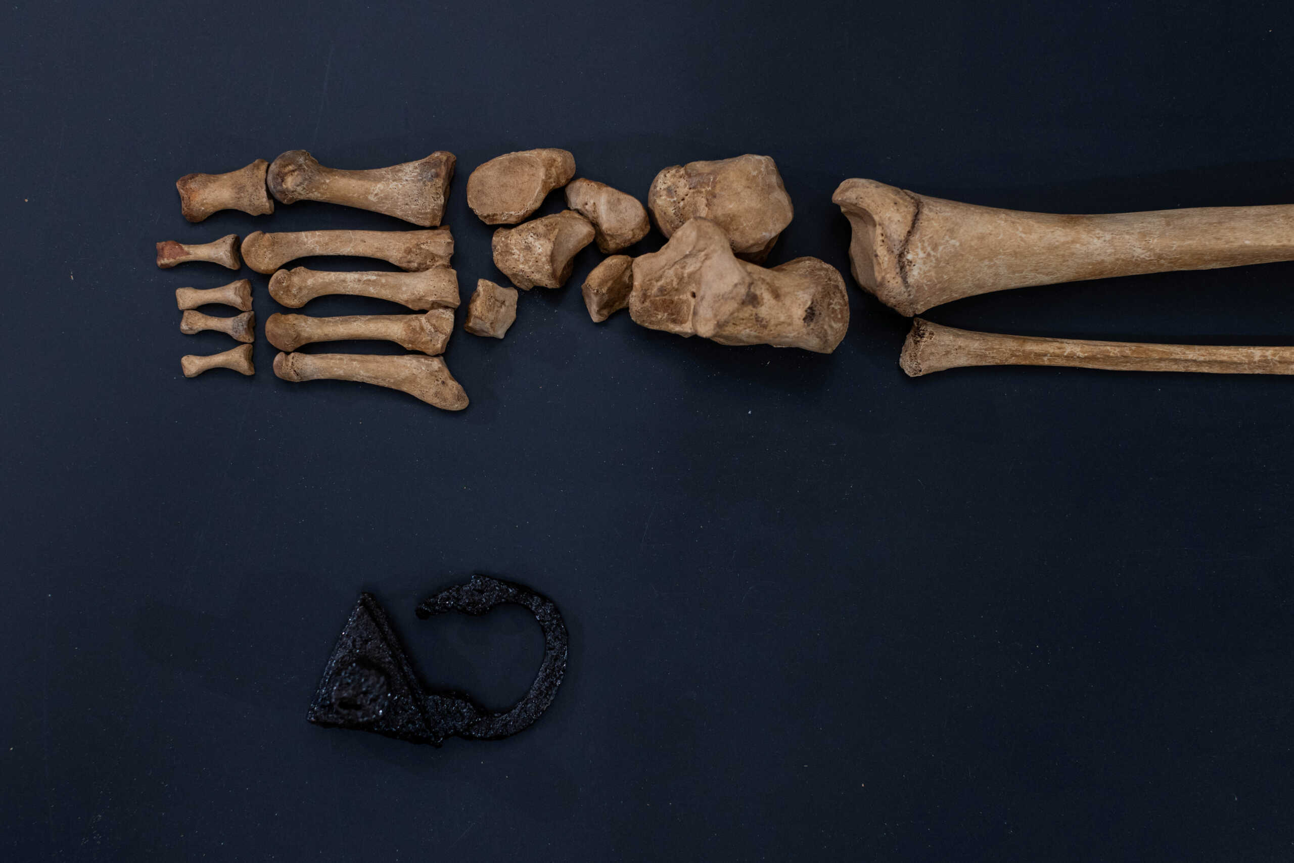 Πολωνία: Αρχαιολόγοι ανακάλυψαν τα οστά «βαμπίρ» του 17ου αιώνα, ενός παιδιού που θάφτηκε με λουκέτο στα πόδια