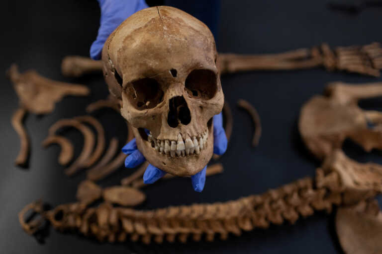 Αρχαιολόγοι στην Πολωνία ανακάλυψαν τα οστά «βαμπίρ» του 17ου αιώνα, ενός παιδιού που θάφτηκε με λουκέτο στα πόδια