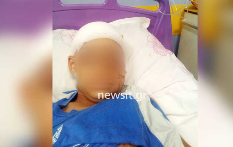 «Το πρόσωπο του παιδιού έχει παραμορφωθεί» λέει στο newsit.gr ο πατριός του 11χρονου που δέχτηκε άγρια επίθεση από πιτ μπουλ στην Αρτέμιδα