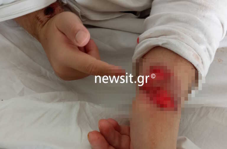 Πατέρας καταγγέλλει ιδιωτικό θεραπευτήριο στο newsit.gr για τον βασανισμό του γιου του που είναι ΑμεΑ - «Ήταν ετοιμοθάνατος σε ένα φορείο»
