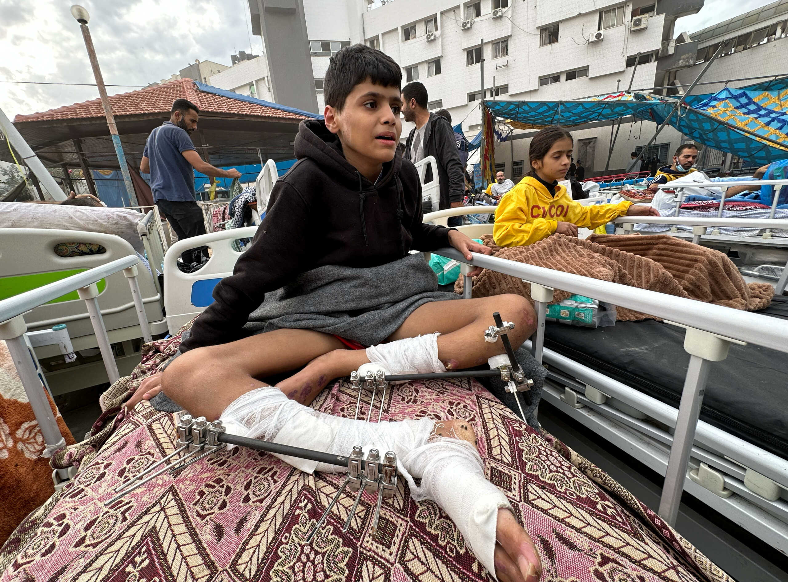 ΠΟΥ: Δραματική προειδοποίηση για τη Γάζα – «Περισσότεροι άνθρωποι θα πεθάνουν από ασθένειες παρά από βομβαρδισμούς»