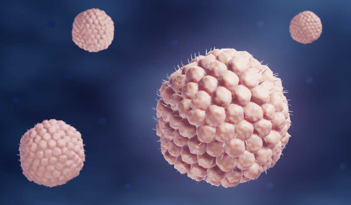Varicella-zoster virus causing Chickenpox (varicella) or Shingles (herpes zoster)