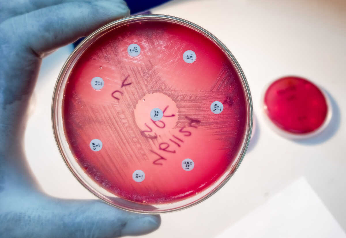 Antimicrobial susceptibility testing in petri dish. Antibiotic sensitive and resistance of bacteria.