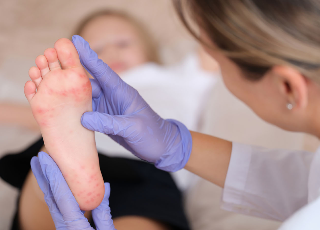 Doctor conducts medical examination of leg of child with red itchy rash closeup. Enterovirus infection symptoms and treatment concept