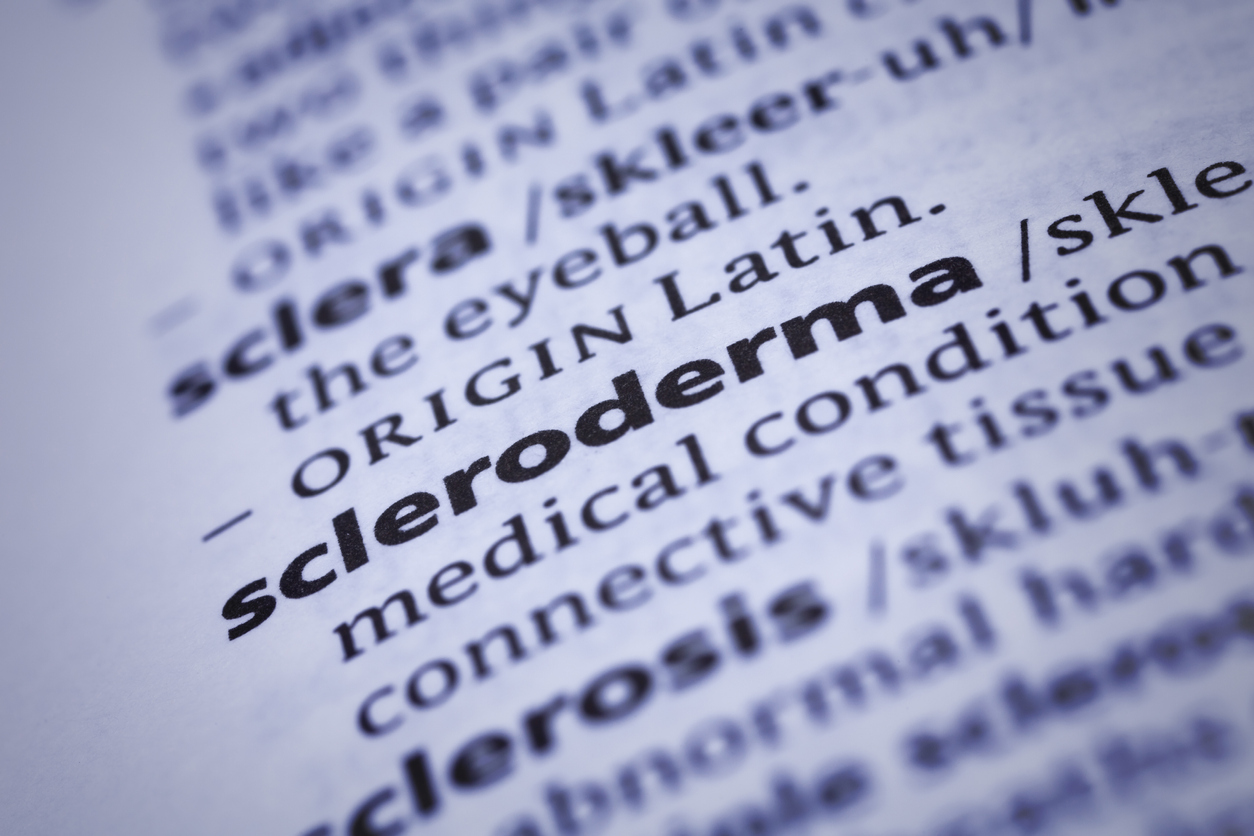 Scleroderma: Dictionary Close-up. Scleroderma, also known as systemic sclerosis, is a chronic systemic autoimmune disease characterised by hardening (sclero) of the skin (derma). In the more severe form, it also affects internal organs. Selective focus and Canon EOS 5D Mark II with MP-E 65mm macro lens.