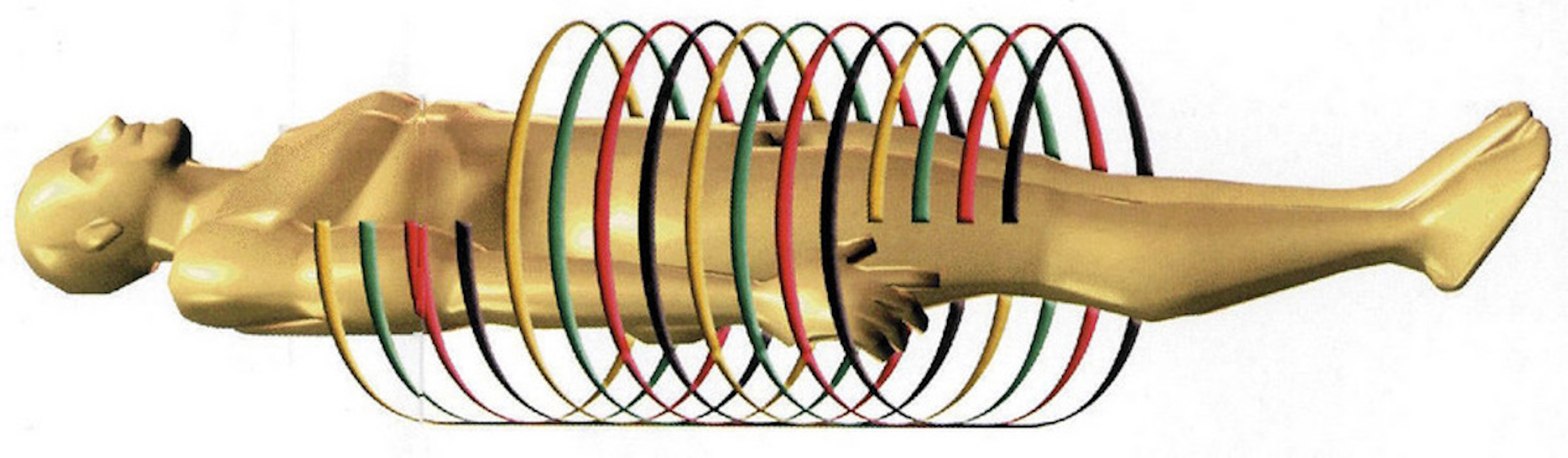 I07 - 20000519- MILAN-ITALY  - A special new image made by computer of the new spiral Tac for inspecting cancer presented Friday 19 May 2000 in a Milan hospital by a team of Italian doctors. This special Tac is for early cancer diagnosis especially for caner's in the pulmonary area .   EPA PHOTO ANSA