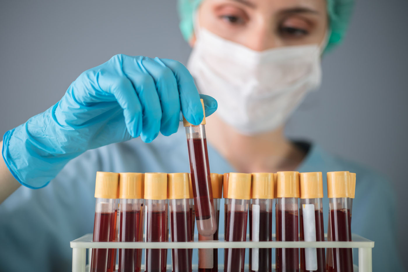 Μια απλή εξέταση αίματος μπορεί να δείξει πόσο γρήγορα γερνάνε το όργανα του σώματος