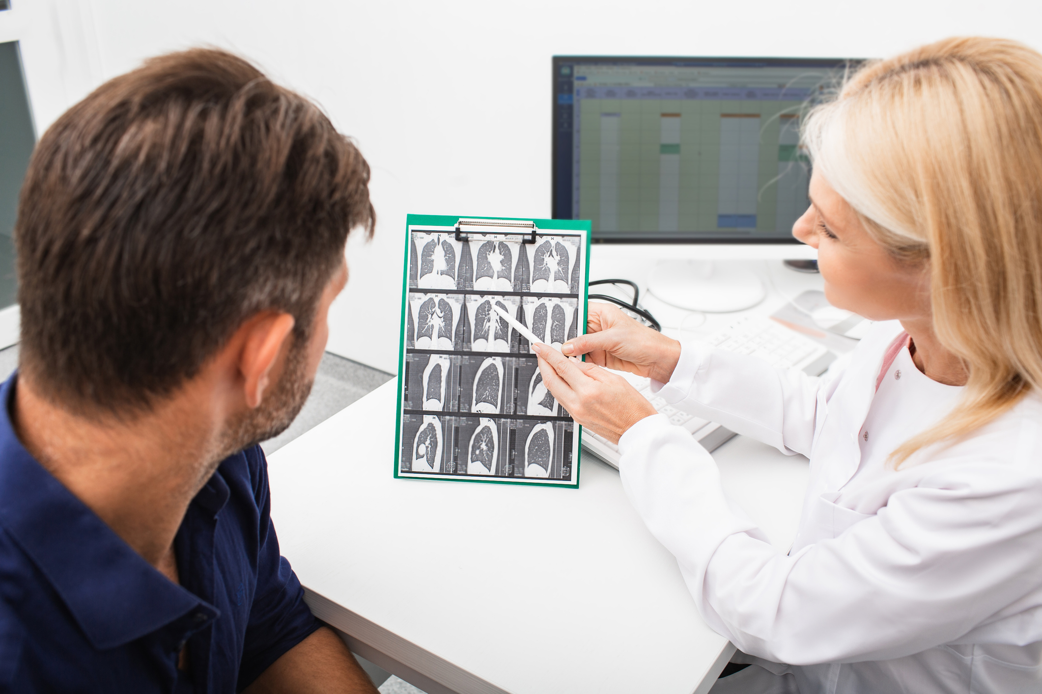 Pulmonologist showing a man patient a CT scan of his lungs pulmonary fibrosis, after recovery, lung disease