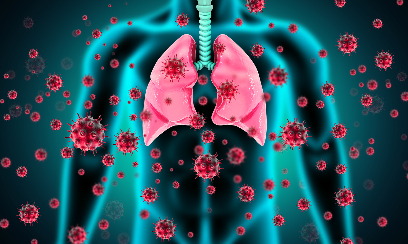 Virus and bacteria infected the Human lungs. lung disease. 3d illustration