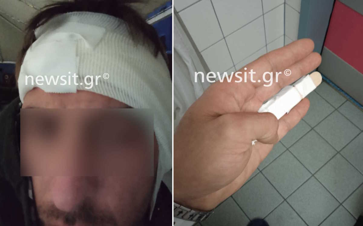 «Δάγκωσε το αυτί μου και έκοψε κομμάτι με τα δόντια του» – Τι περιγράφει στο newsit.gr ο διανομέας από την Πέλλα