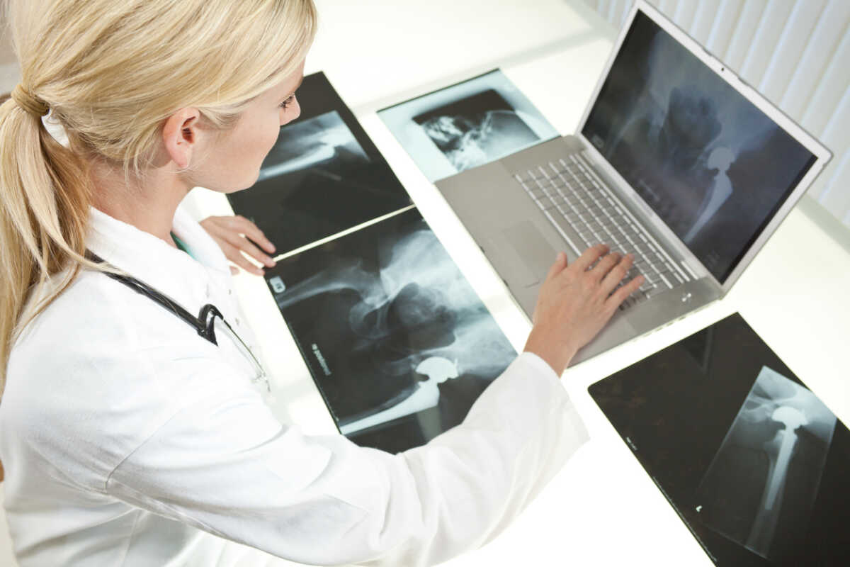 A blond female medical doctor looking at x-rays of hip replacement and using laptop in a hospital