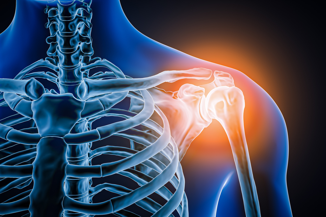 Anterior or front view of human shoulder joint and bones with inflammation 3D rendering illustration. Pathology, articular pain, anatomy, osteology, rheumatism, medical and healthcare concept.
