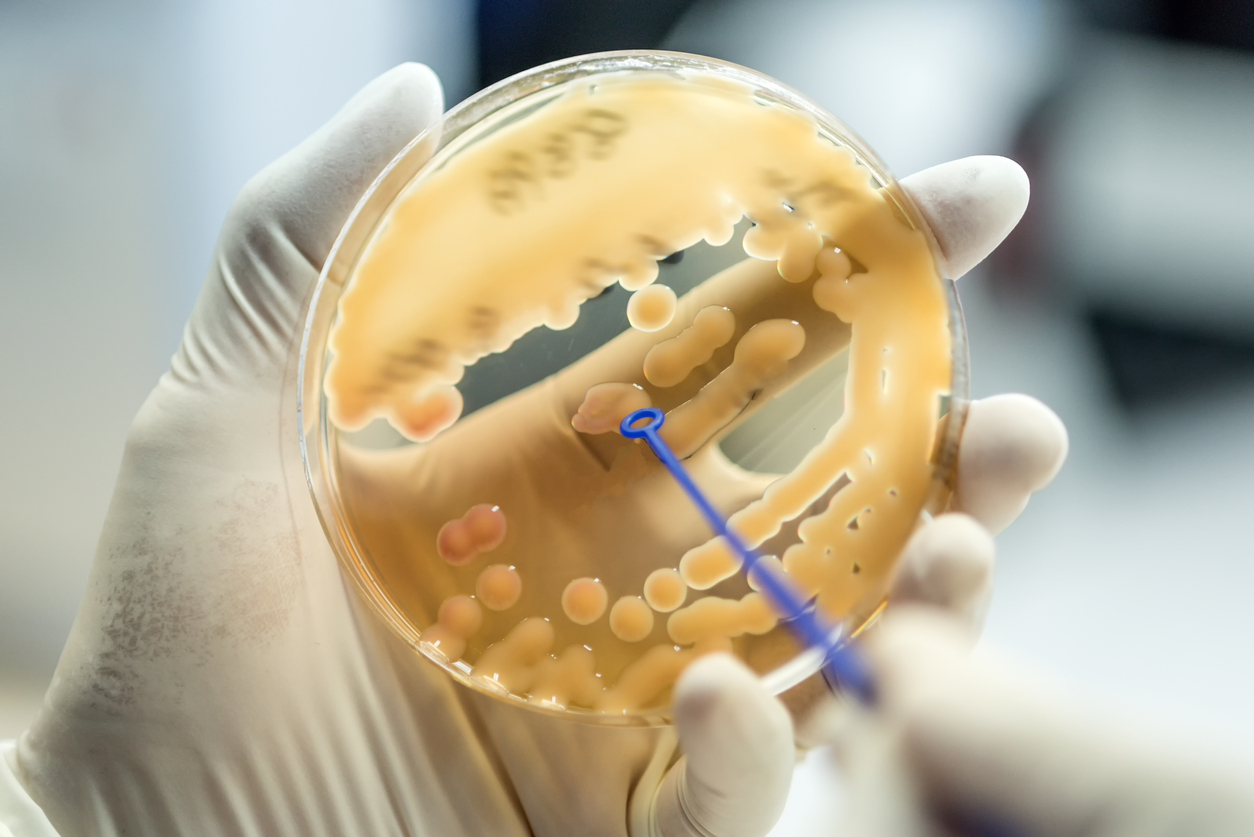 Klebsiella pneumoniae colonies of pink bacteria ferment lactose culture on MacConkey agar in microbiology department hospital.