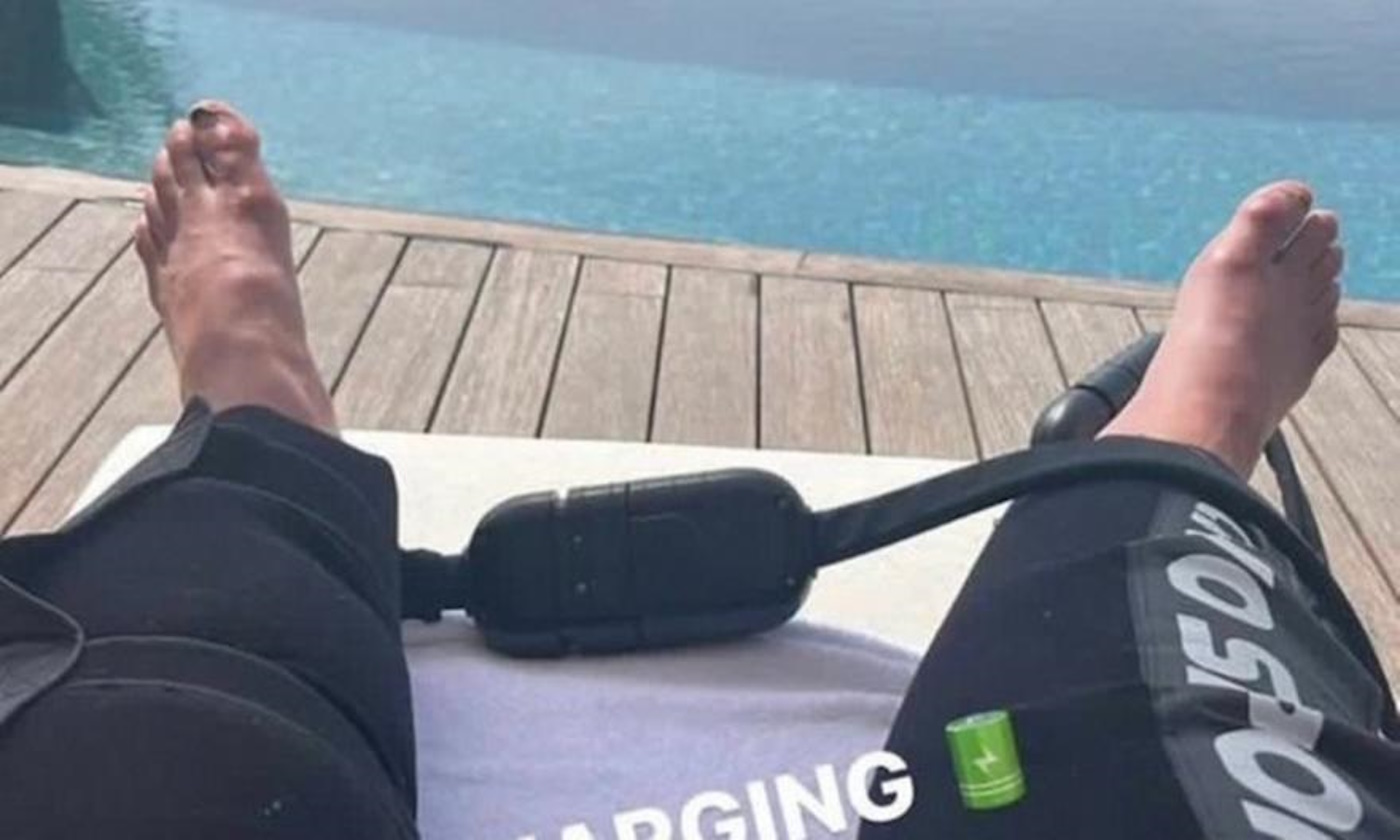 Κριστιάνο Ρονάλντο: Η φωτογραφία με τα πρησμένα του πόδια που έγινε viral