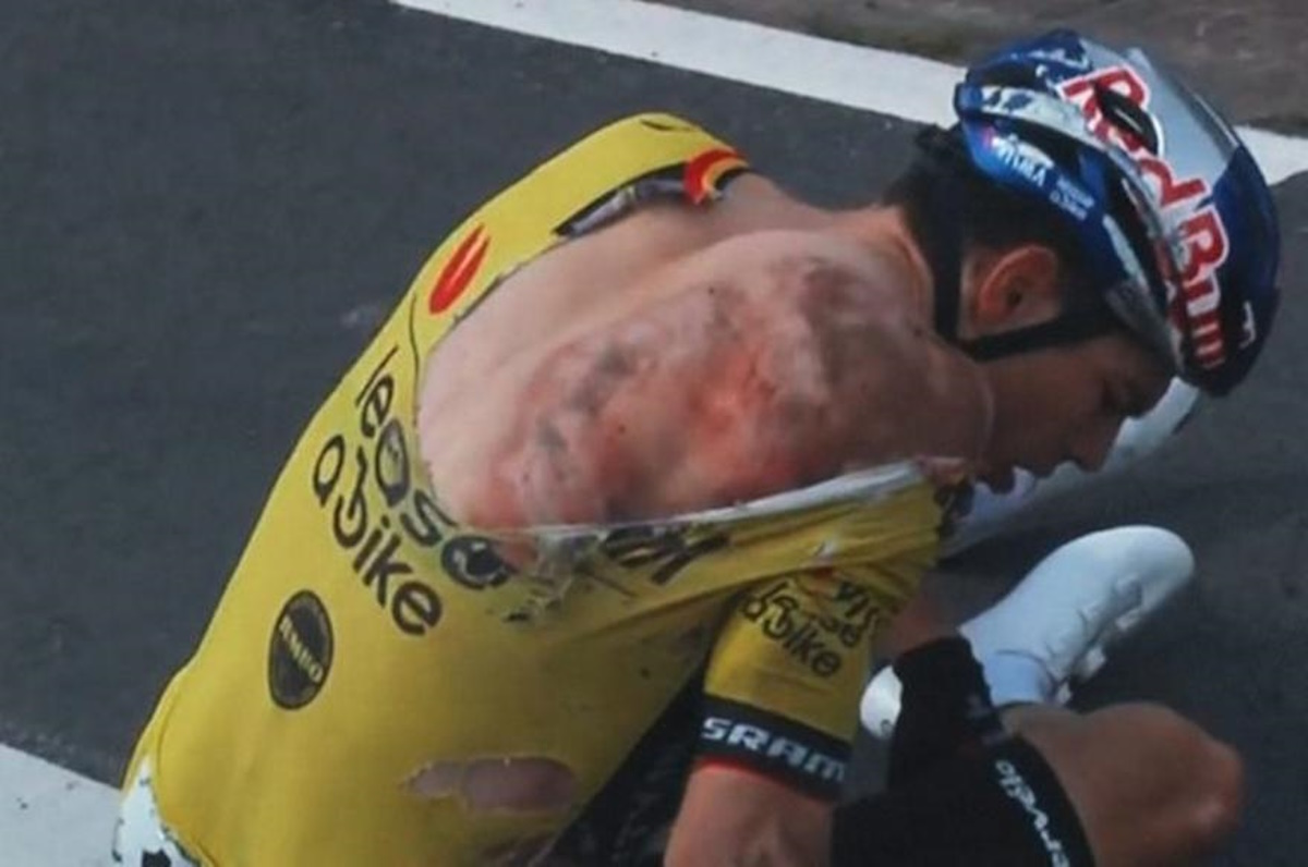 Τρομακτική καραμπόλα σε αγώνα ποδηλασίας: Έσπασε την κλείδα του ο παγκόσμιος πρωταθλητής Βάουτ Βαν Αρτ