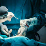 concentrated professional surgical doctor team operating surgery a patient in the operating room at hospital. tumor cancer. surgical biopsy specimens. healthcare and medical concept."n