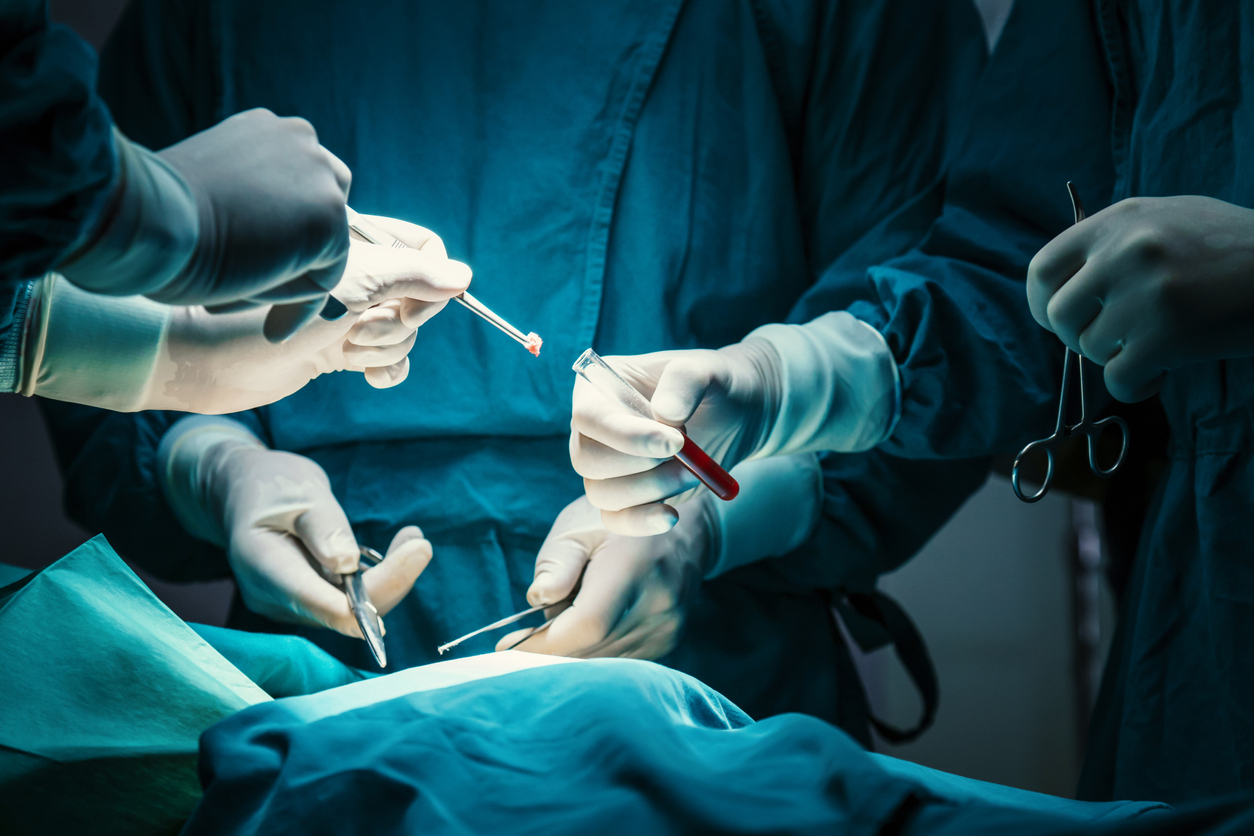 concentrated professional surgical doctor team operating surgery a patient in the operating room at hospital. tumor cancer. surgical biopsy specimens. healthcare and medical concept."n