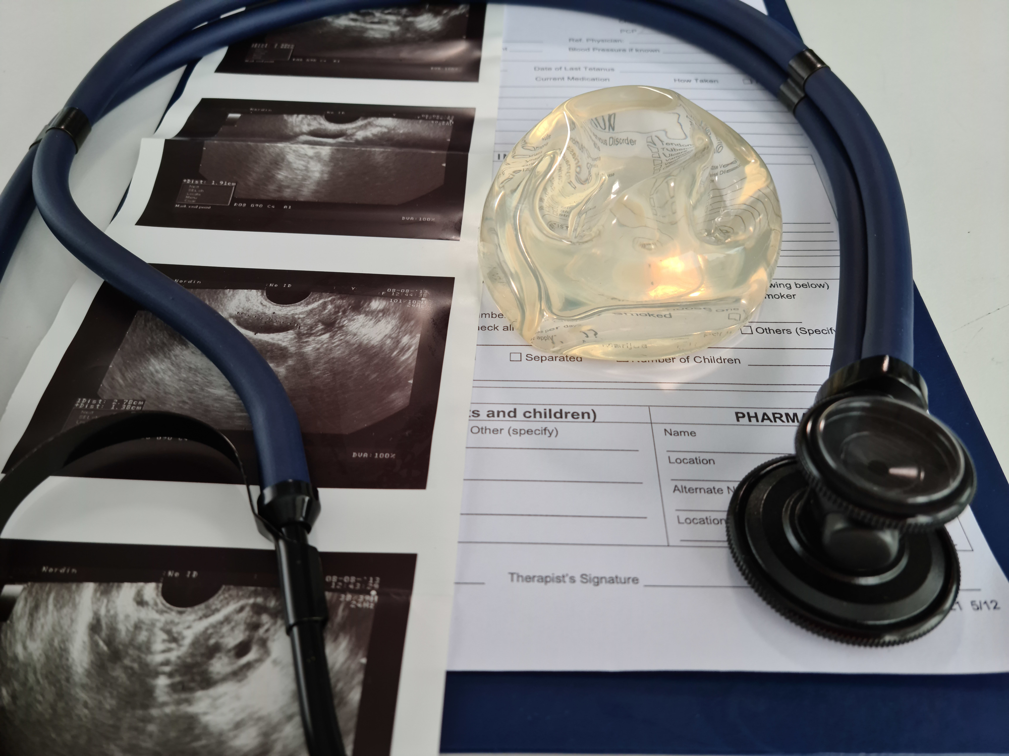 Ultrasound of the mammary gland with silicone implant. X-ray chest concept