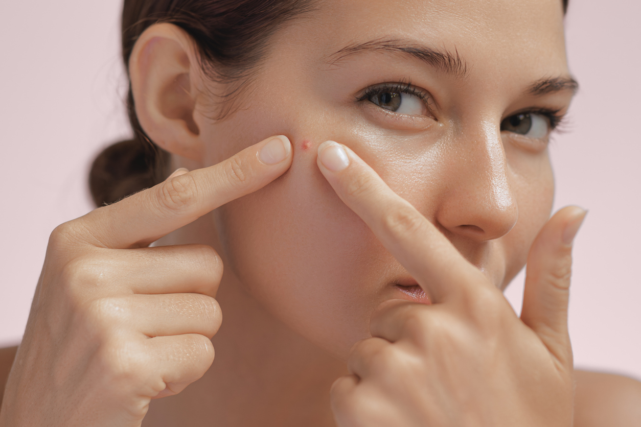 Skin problem. Depressed woman touching pimple on face looking at mirror. Facial skin issues, medical care, and treatment concept. Selective Focus. High-quality photo