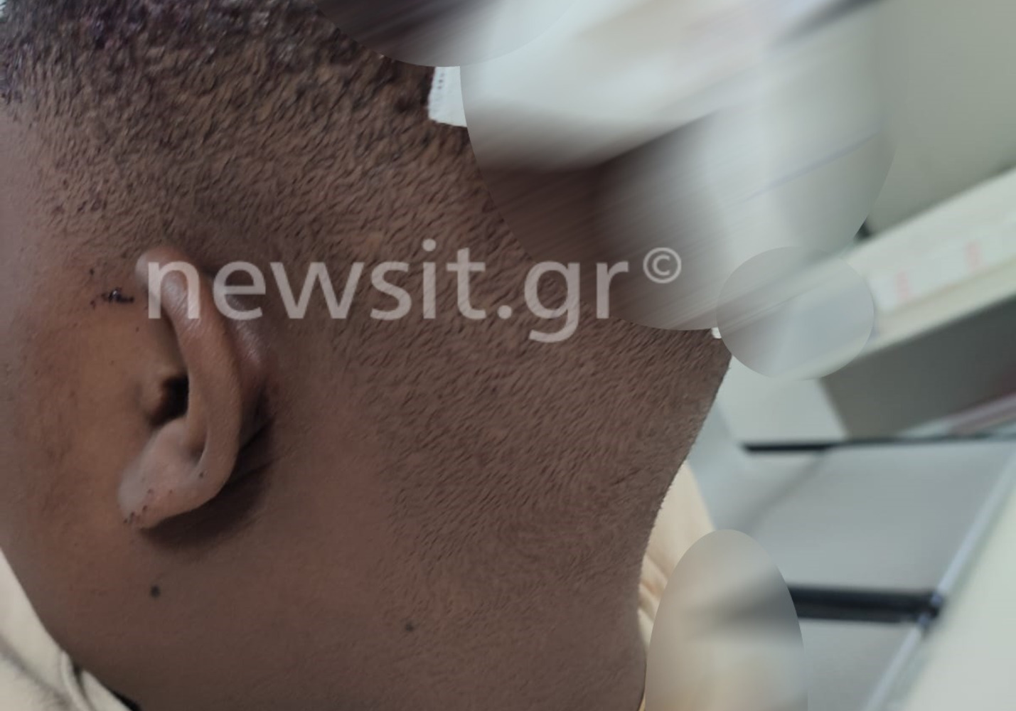 Τι λέει στο newsit.gr το 18χρονο θύμα επίθεσης με σφυρί από 19χρονο Γεωργιανό σε Γυμνάσιο