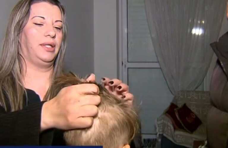 Δασκάλα κούρεψε 5χρονο σε νηπιαγωγείο γιατί δεν της άρεσαν τα μαλλιά του – «Η κυρία είπε ότι αν δεν τα κόψω θα φωνάξει την αστυνομία»