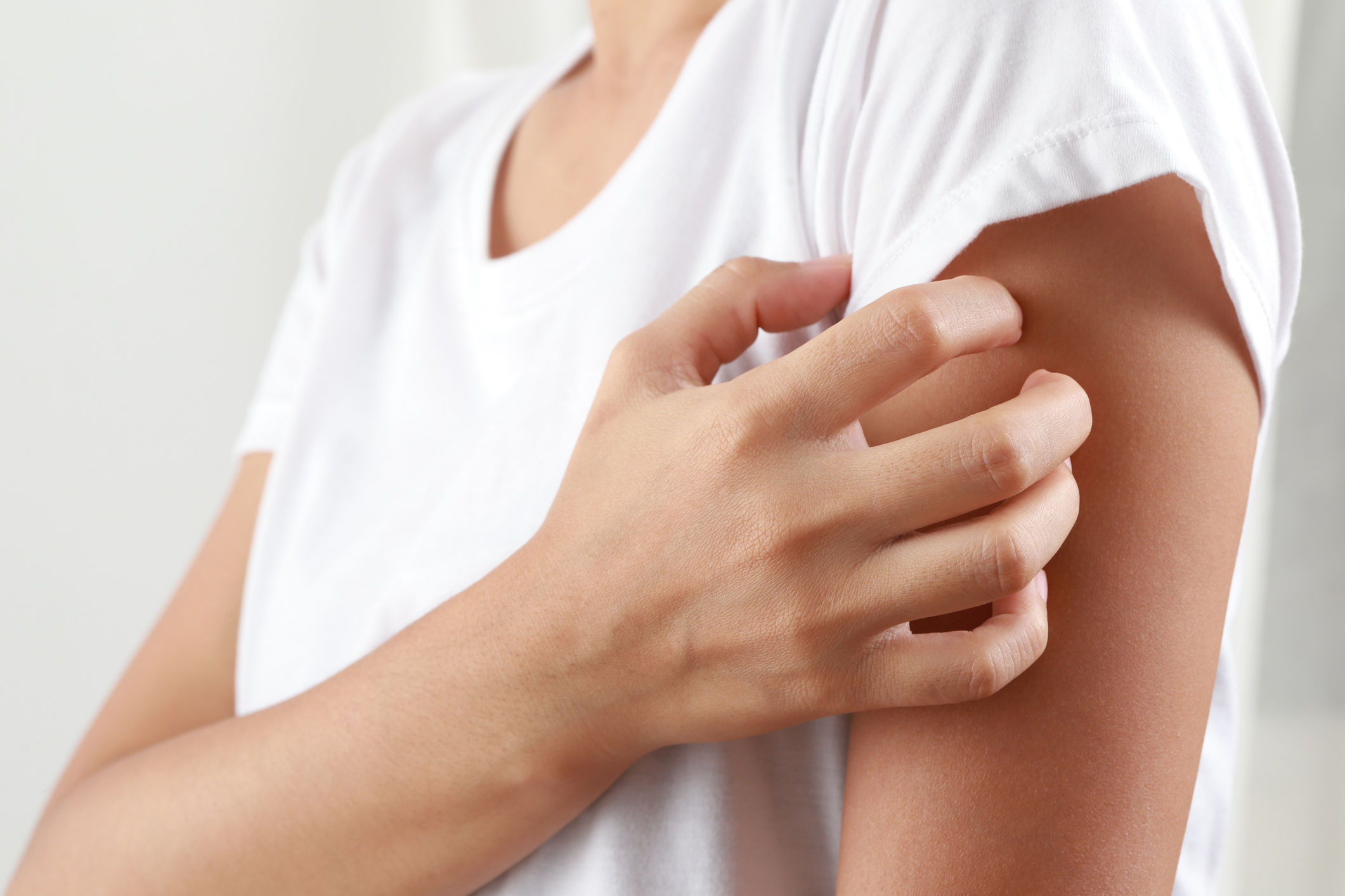Girl itching on skin caused by fungus, dermatitis, drug allergy, food allergy, allergy.