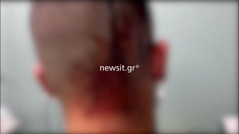 Ντοκουμέντα σοκ από την επίθεση με μαχαίρια και σιδερολοστούς σε δύο αδέρφια στη Νέα Φιλαδέλφεια - Τι λέει ο πατέρας τους στο newsit.gr