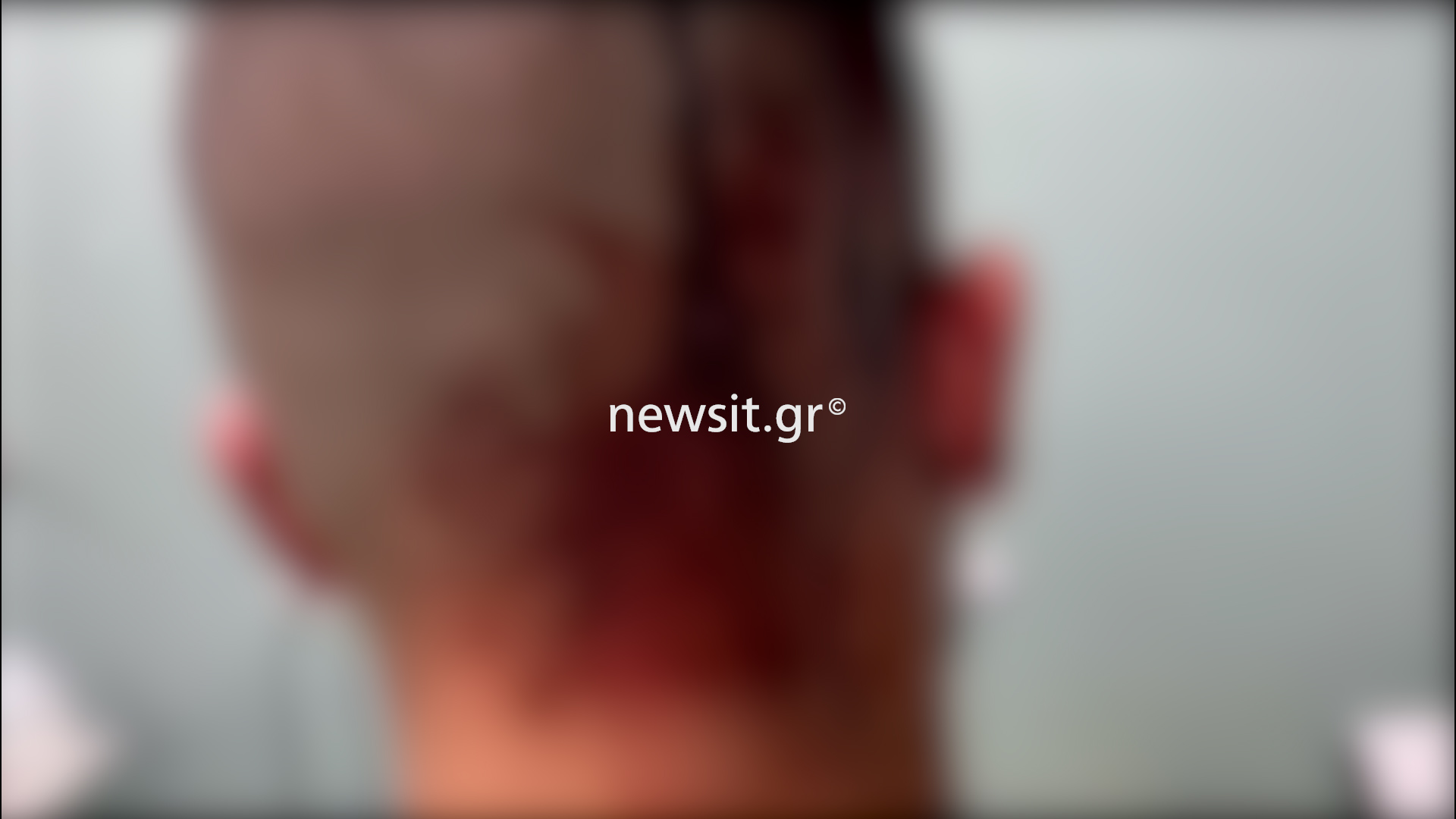 Νέα Φιλαδέλφεια: Άγρια επίθεση με μαχαίρια και σιδερολοστούς σε δύο αδέρφια – Τι λέει ο πατέρας των θυμάτων στο newsit.gr
