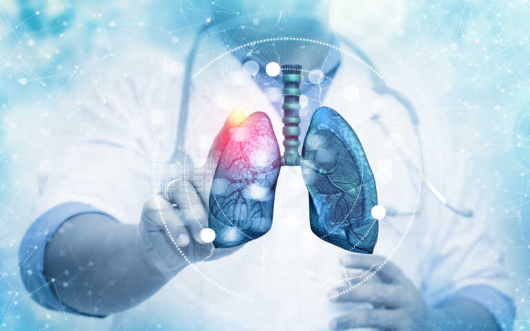 Καρκίνος του πνεύμονα: Μια εξέταση μπορεί να αναγνωρίσει πρώιμα στάδια