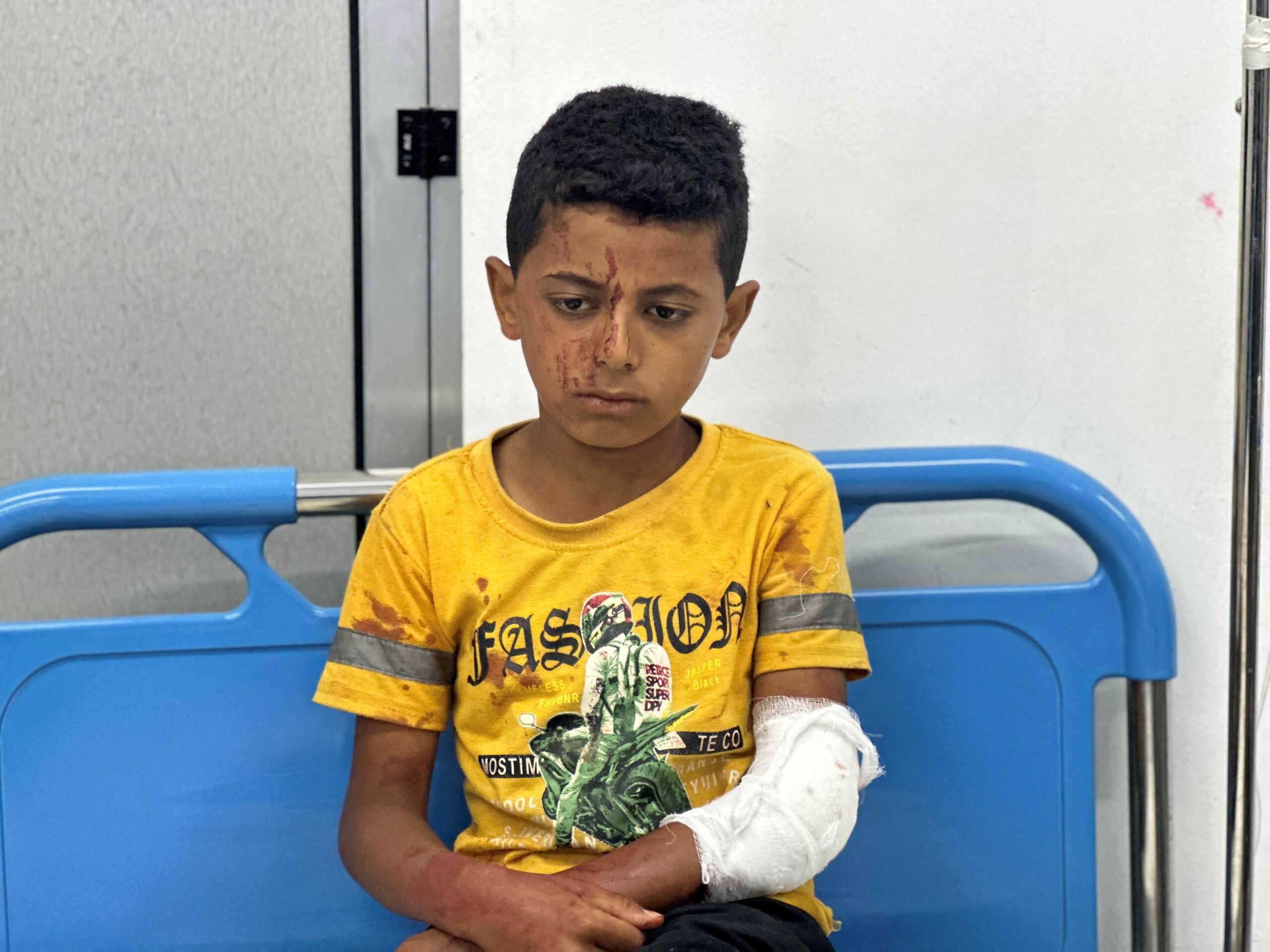 SENSITIVE MATERIAL. THIS IMAGE MAY OFFEND OR DISTURB  A Palestinian child, wounded in an Israeli strike on an area designated for displaced people, sits at a hospital, amid the ongoing conflict between Israel and Hamas, in Rafah in the southern Gaza Strip, May 26, 2024. REUTERS