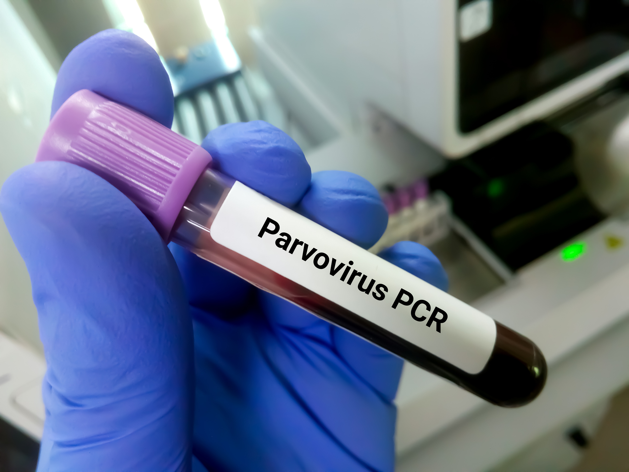 Blood sample for Parvovirus PCR test