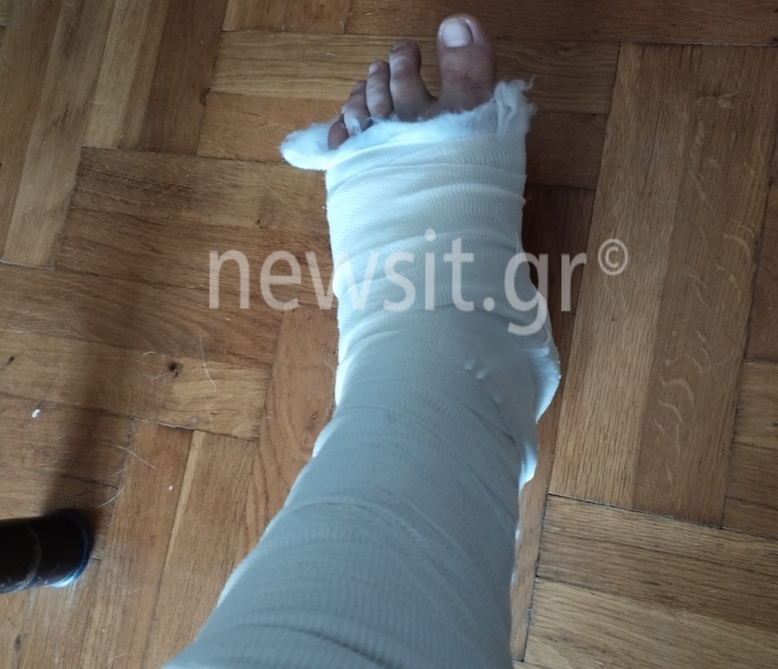 Θεσσαλονίκη: «Ήταν ημίγυμνος και μας όρμηξε στα καλά καθούμενα» λέει ο οδηγός του απορριμματοφόρου που δέχτηκε επίθεση