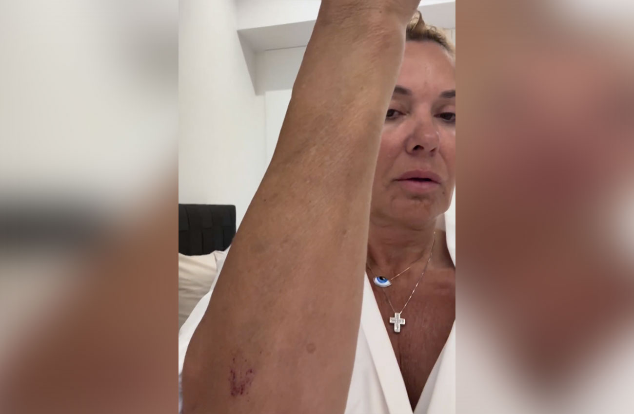 Η Χριστίνα Παππά έπεσε θύμα ξυλοδαρμού στη Γλυφάδα – «Με έβρισε, με χτύπησε και με πάτησε με το αυτοκίνητο»