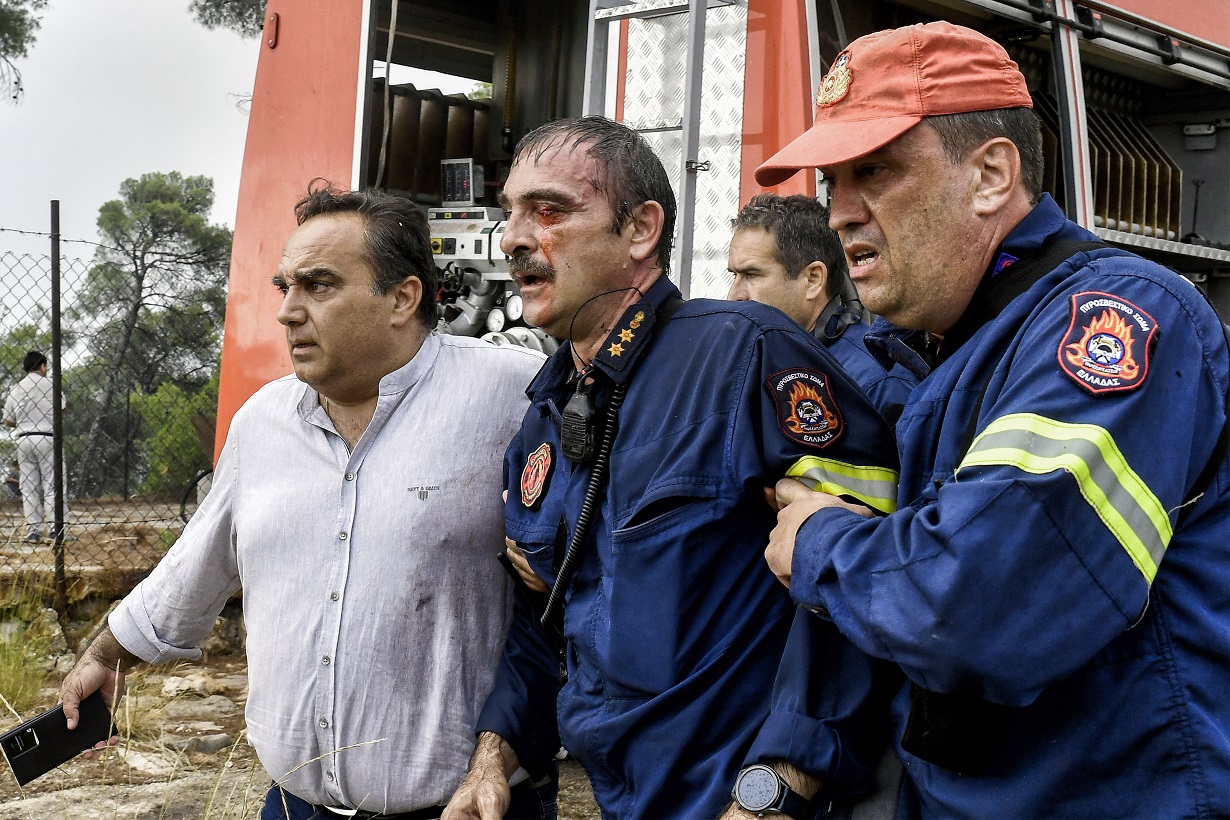 Πυρκαγιά στο Σοφικό Κορινθίας, Τρίτη 23 Ιουλίου 2024. Στο στιγμιότυπο ο τραυματισμός στο μάτι του Υποδιοικητή της Πυροσβεστικής Υπηρεσίας Κορίνθου Μιχάλη Πιλάνδρα κατά την διάρκεια της επιχείρησης για την κατάσβεση της φωτιάς. 
(ΒΑΣΙΛΗΣ ΨΩΜΑΣ