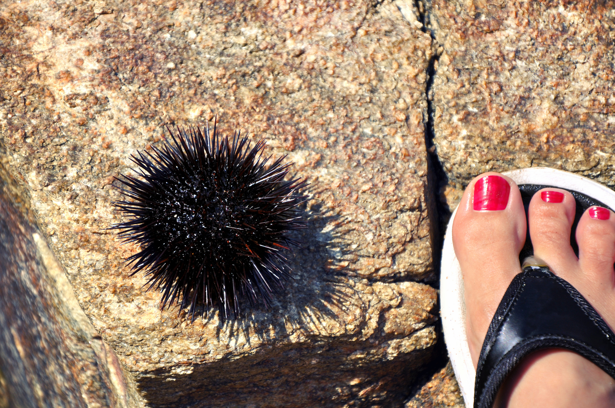 Sea urchin close female foot on the rock. Summer concept