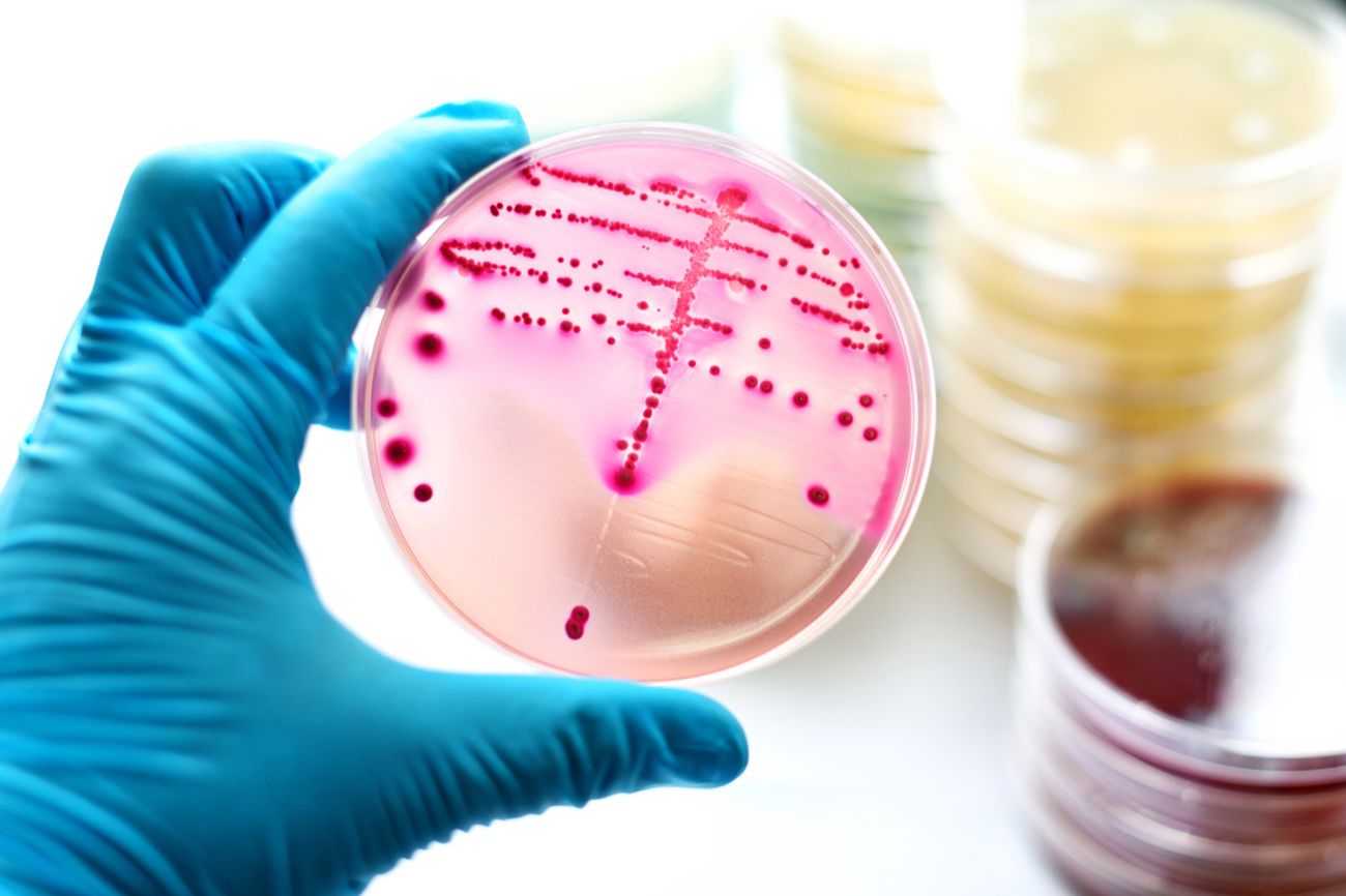 Colonies of bacteria in MacConkey agar (culture medium plate)