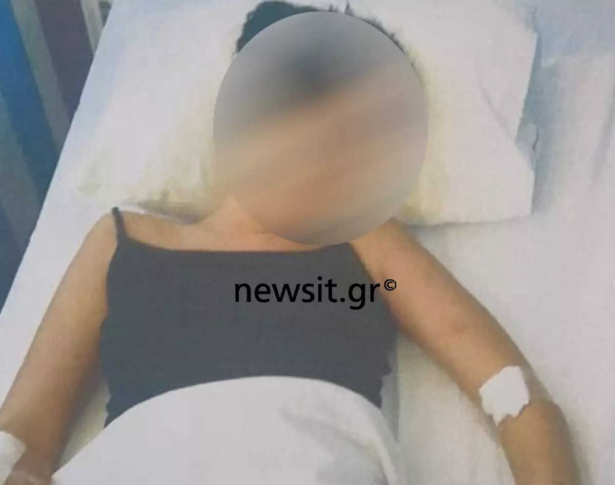 Χαλκίδα: Τρέμει για τη ζωή της η 19χρονη που ξυλοκοπήθηκε άγρια από τον 23χρονο σύντροφό της