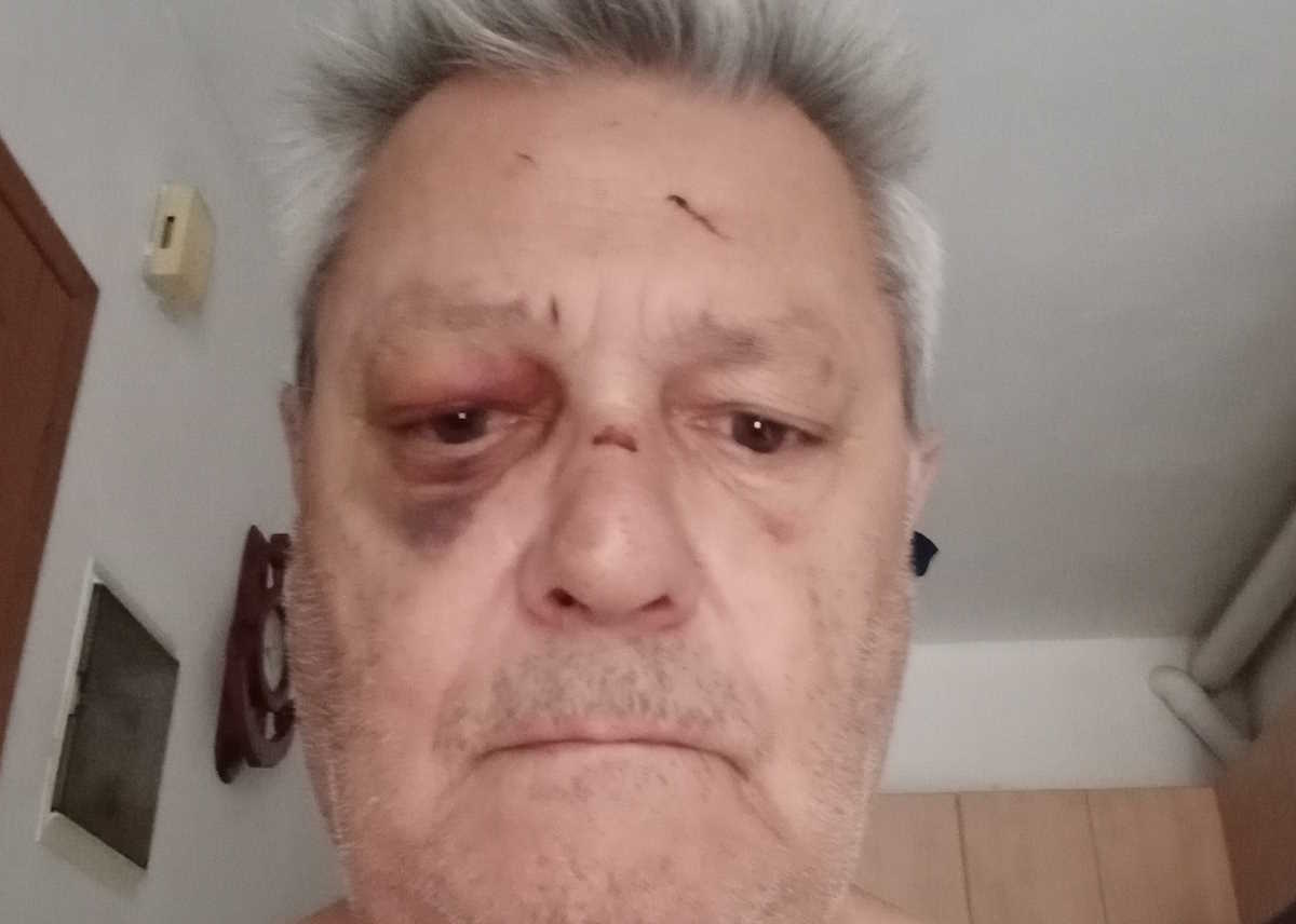Λαμία: Ληστής γρονθοκόπησε 65χρονο και κλώτσησε το σκυλάκι του